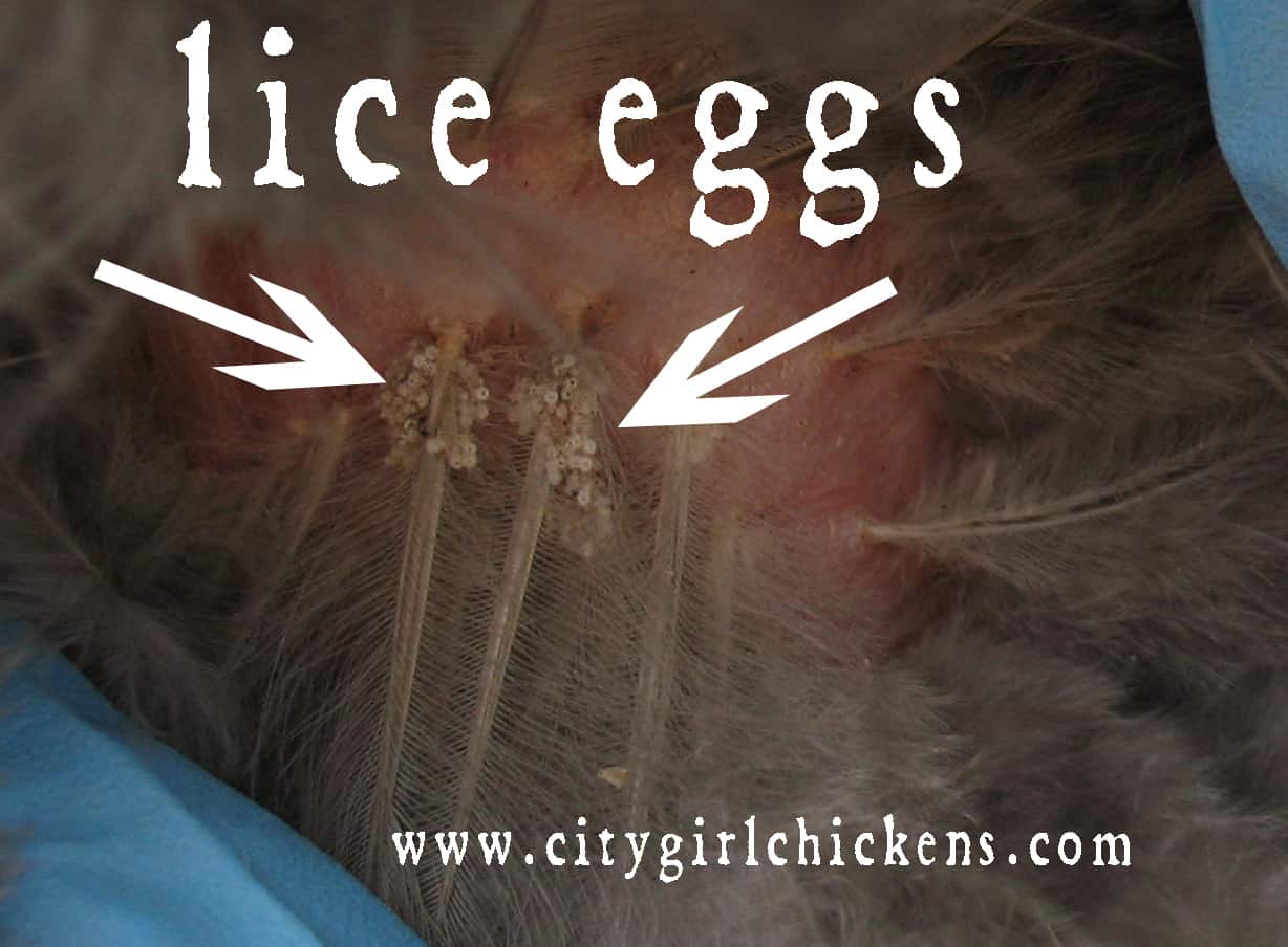 Lice Egg Pictures